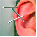 auricular acupuncture ruislip middlesex
